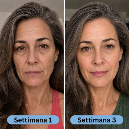 Elorivia VoluFine — Risultato Settimana 1 vs 3
