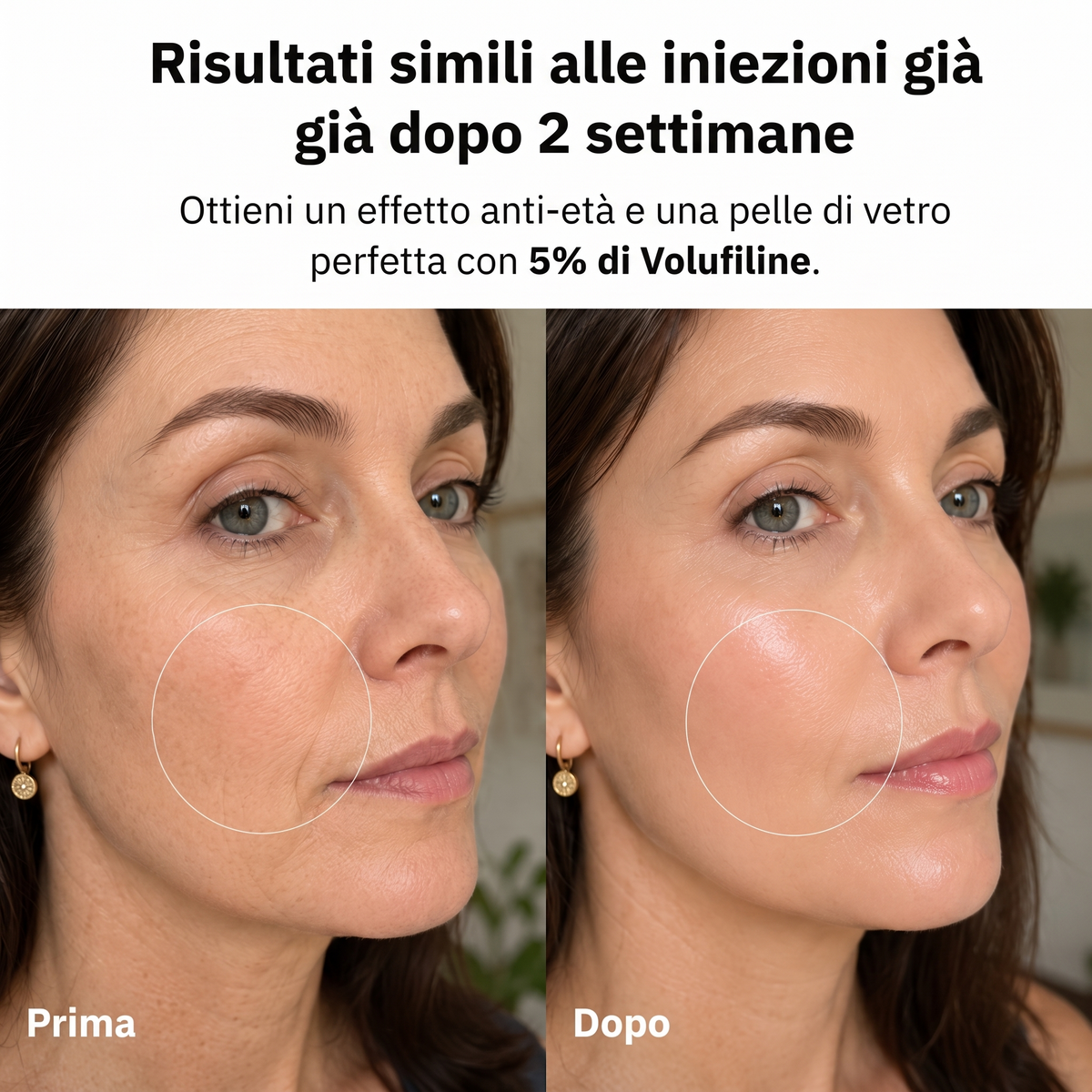 Elorivia VoluFine — Risultati simili alle iniezioni
