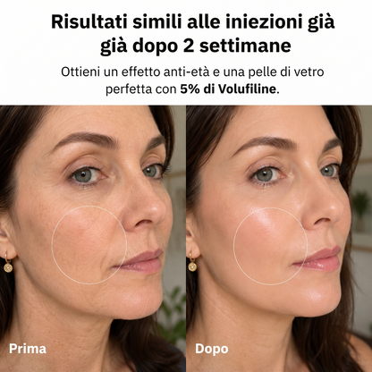 Elorivia VoluFine — Risultati simili alle iniezioni